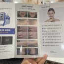 메디포올 이미지