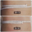 월암로 | 대구 달서구 월성동 에스테틱샵 신부관리 하울뷰티 업모드 다이어트