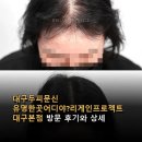어디야 | 대구두피문신 유명한곳어디야?리게인프로젝트 대구본점 방문 후기와 상세 정보