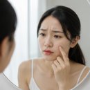 부산영천손한의원 | 부산 편평사마귀 제거 한의원 추천 이후 관리까지