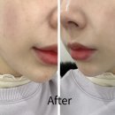 뷰티앤영의원 이미지