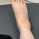 복음한의원 | 어쩌다보니 병가 신세