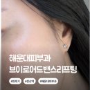 어드밴스 | 해운대피부과 브이로어드밴스 리프팅 효과 후기