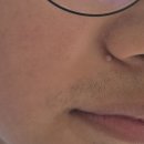경희피치한의원 이미지