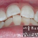 서울프리벤치과의원 이미지