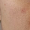 예젤의원 이미지