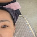 라인앤코 | (내돈내산)엑셀브이 레이저 후 관리가 중요했던 이유, 제주 모나앤코 재생관리 후기