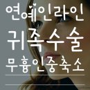 노블캣 | 연예인귀족수술 전후 사진이 세련된 후기
