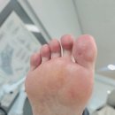 이마트 구로점 앞 | 역곡역 임산부 발각질 관리 푸스케어 구로항동점 후기 괴안동 발각질