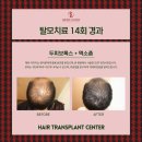 일관메디컬 | 서면 탈모치료 후기 결과보다 먼저 볼 건