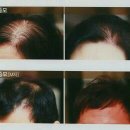 라비쉬헤어 - 남동구 | 라비쉬헤어
