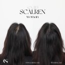 흥미헤어라인 이미지