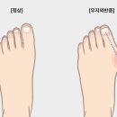 석바위신발 네이버블로그