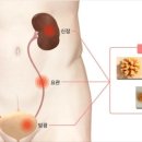 정한수비뇨기과 네이버블로그
