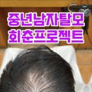 중년남자탈모회춘프로젝트 부산사상르네시떼6층 탈모헤어클리닉전문미용실 이미지