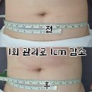 대구 북구 침산동 복부비만다이어트 눈썹하다 더조각 에너지테라피 후기