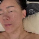 더나인 | [유성 피부샵] 봉명동 피부관리 | 더나인스킨 | 소프트플라즈라 관리 후기