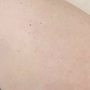 사회복지법인전석복지재단소망의원 | [2학년 1학기] 약쟁이가 되다. | 간호학과 백신 접종일지