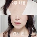 (주)메디하이 네이버블로그