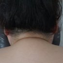 스킨힐링스