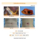 담낭제거수술후. 건강검진결과 담낭쪽 내부 용종 1.6cm로 판명, 인터넷으로 병원 알아보던 중 청담튼튼병원 김정윤 원장님께서 담낭쪽에서 권위자이시고... 이미지