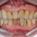 로스윌최병택치과의원 | 공덕치과 - 로스윌최병택치과의원 &#34;심미치료&#34;