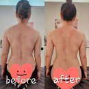 에이앤유필라테스테라피 | 안성 마사지 에이앤유필라테스에서 뭉친 근육을 풀어요