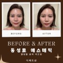 세븐일레븐파장본점 | 대구 윤곽관리 디에뜨샵 얼굴관리 후기