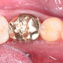 에르메스치과기공소 이미지