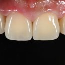 엠웍스 치과기공소 이미지