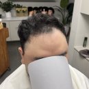 (유)호남관리 | 마산가발 추천 자연스러운 부분가발 후기