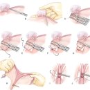 The Cats & Dog | 개·고양이 자궁축농증과 난소자궁절제술(OHE): 진단부터 수술·약물치료까지 임상 핵심 정리