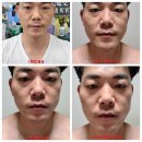 시투안바이코즈볼 팩과 각종 제품 제품 사용 후기 입니다 말이필요없다ㅡ사진으로
