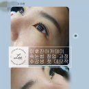이후진 이미지