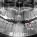 아이조은치과의원 네이버블로그