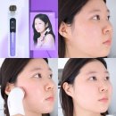 (주)스마트메디칼디바이스 | 뷰티 디바이스 추천,EOA 풀텐자 장나라 피부 홈케어 관리기 1주일 리얼 후기