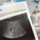 이화 더블유 산부인과