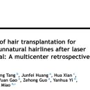 흥미헤어라인 이미지