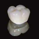 튼튼치과기공소 이미지