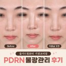 지에스 메디칼 | 기장피부관리 올가드림뷰티에서 PDRN 물광관리 받은 후기