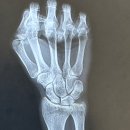 도곡타워정형외과의원 이미지