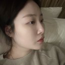 신논현피부과 밋밋한 코 고민 해결! 콧대필러 전후 후기