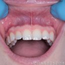 나란이치과교정과치과의원 네이버블로그