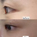 죽전아이뷰 | [ 대구 속눈썹 잘하는 곳 ] 뷰티플러스 죽전점
