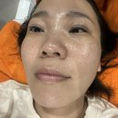 인제케어메디칼 이미지