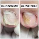 케이큐어 이미지
