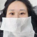 정관장갤러리아진주점 | 진주 시내 속눈썹펌 잘하는 곳 추천 전후 비교 후기