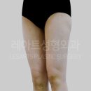 레아트성형외과의원 이미지