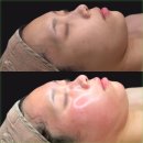 에스테틱새로움 이미지