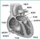 심장병 이미지